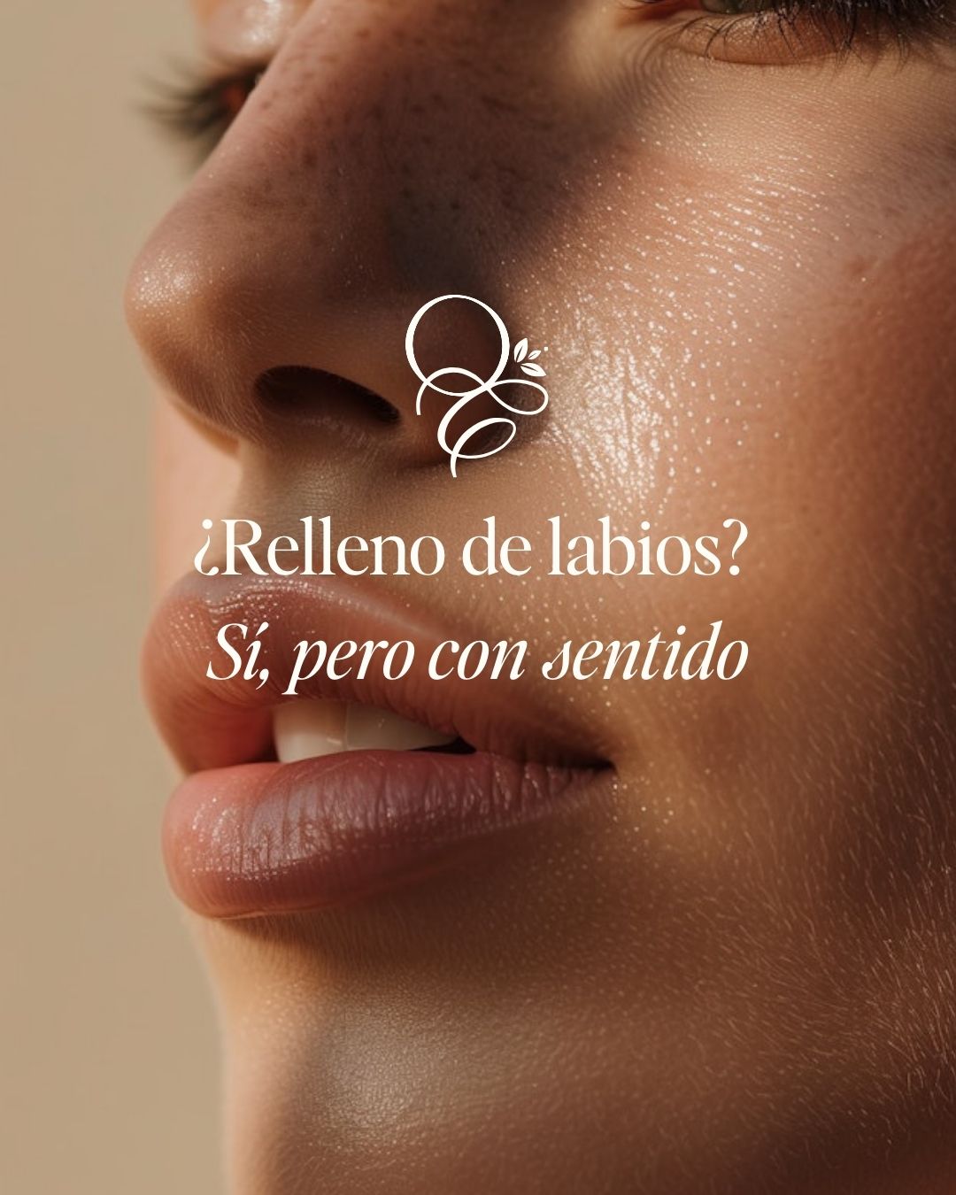 Relleno d elabios- post instagram